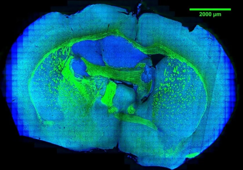 Cross-section of brain tissue labeled and imaged by SRS.