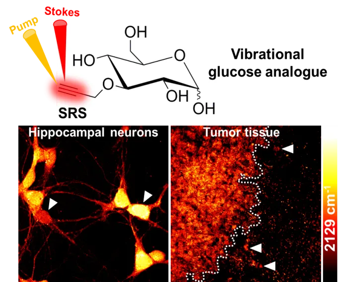 Images of hippocampal neurons and tumor tissue using alkyne labeled glucose analogues.